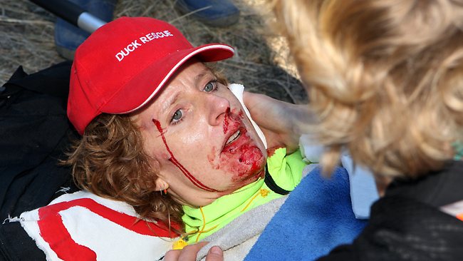 [Austrália] Ativista contra a caça recebe um disparo no rosto